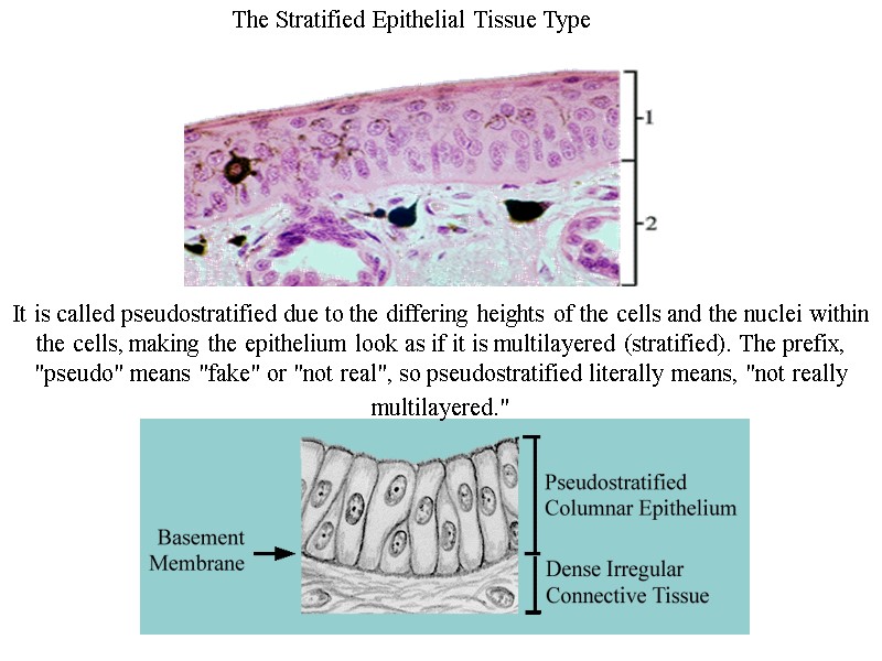 The Stratified Epithelial Tissue Type   It is called pseudostratified due to the